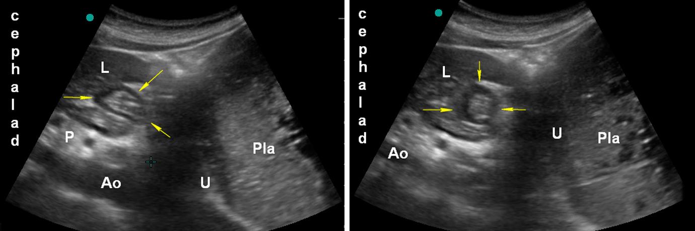 Legend: C: colon; F: foetus; L: liver; P: pancreas; Pla: placenta; U: uterus wall; Yellow arrows: empty antrum.